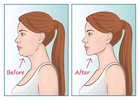 But does mewing really work? The tongue-chewing practice alone may not give you a chiseled jawline overnight, it can be a helpful addition to your facial exercise routine. By engaging the muscles of the tongue, you're also working the muscles of the lower face and neck, which can help to define the jawline over time. ‍ 